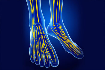 nerve damage neuropathy
